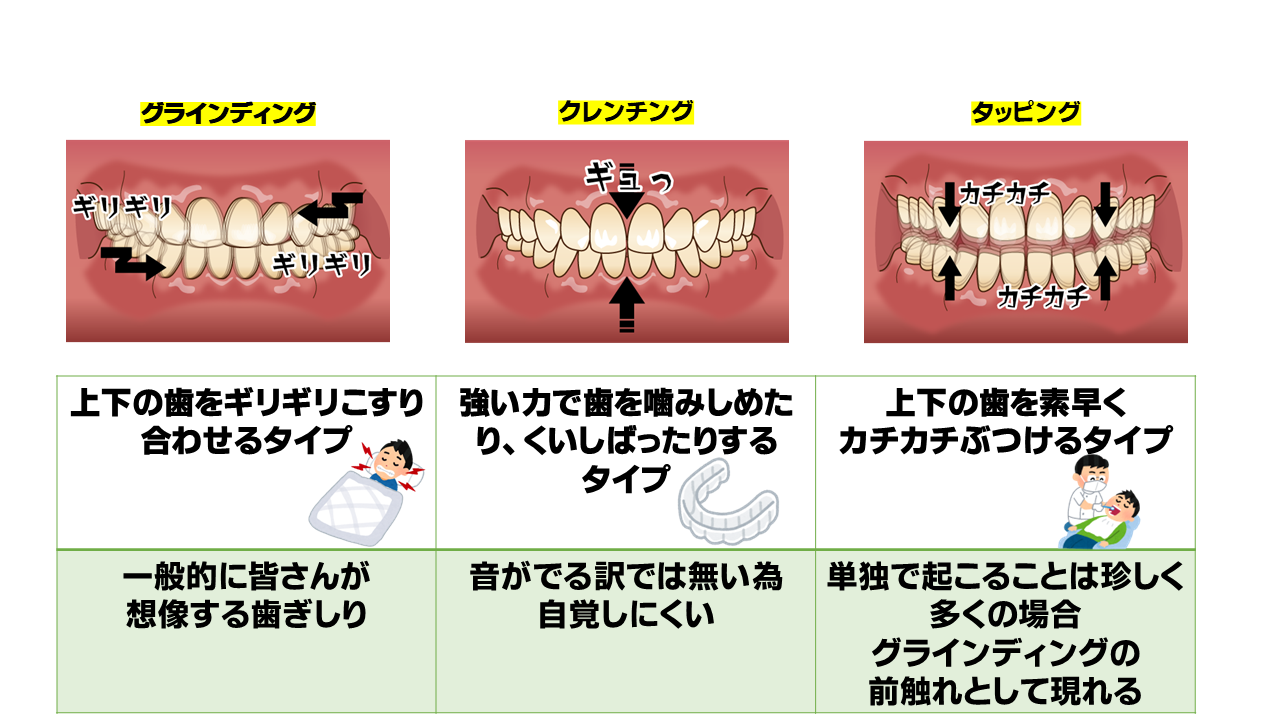 歯ぎしり